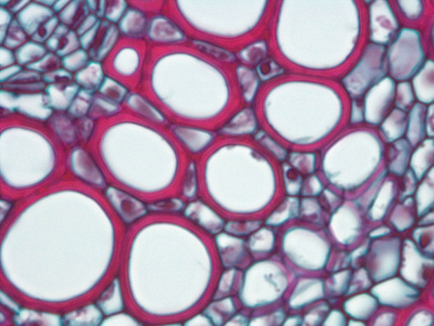 Plant Vascular Tissue Slides - Plant Vascular Tissue 02 1000X